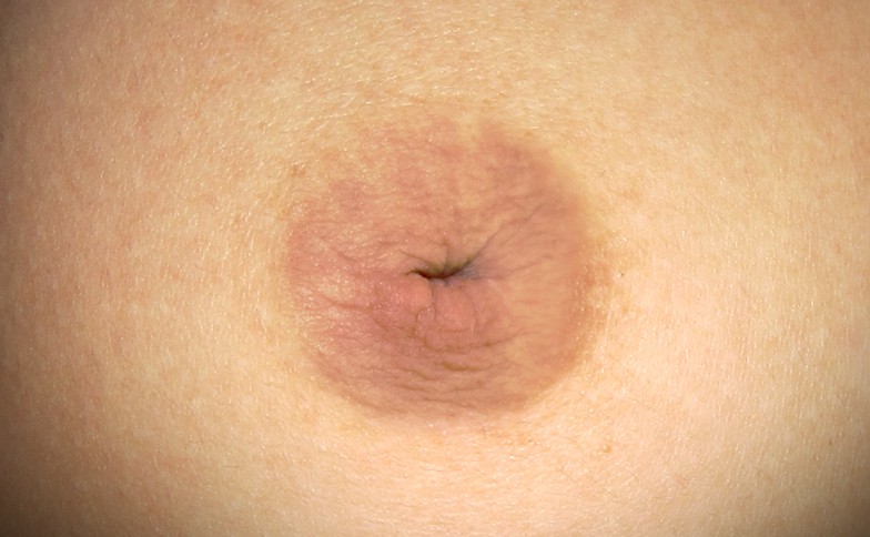 Picture Of Inverted Nipples 27