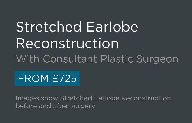 Stretched Earlobe Reconstruction Leeds and Harrogate - Introduction
