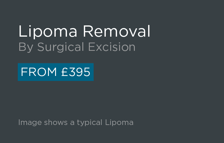 Lipoma Removal
