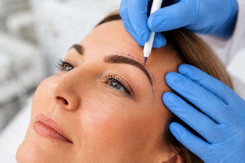 eyelid browpexy surgery