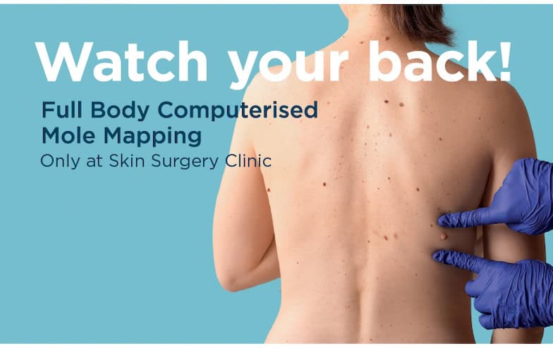 Mole Mapping Watch Your Back Mole Mapping Watch Your Back