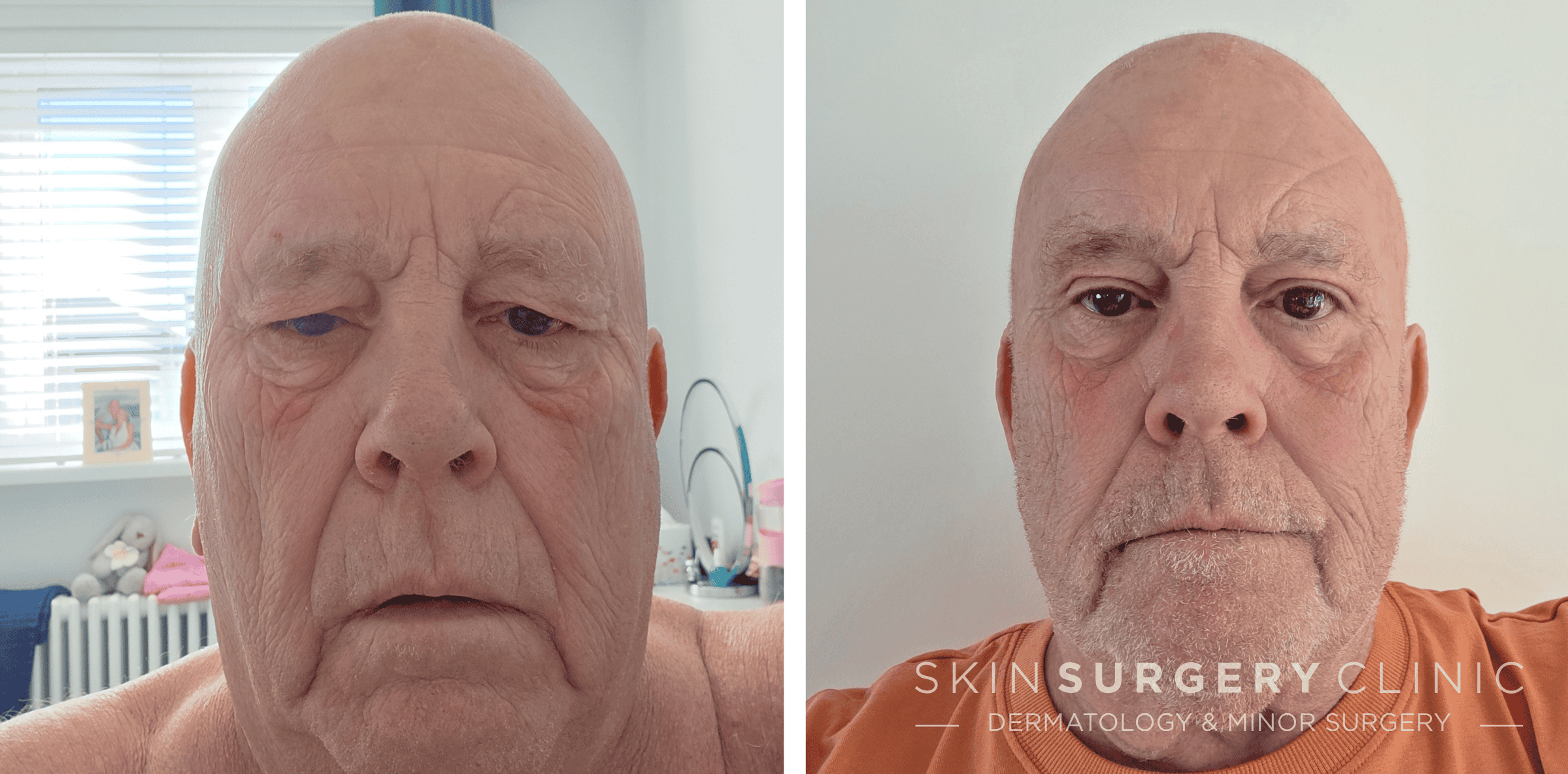 DW_B&A DW_B&A